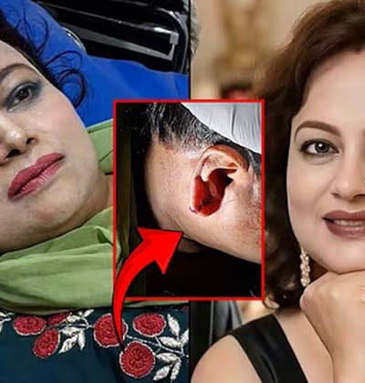 ছিনতাইকারীর হামলায় আহত অভিনেত্রী রঞ্জিতা কনা