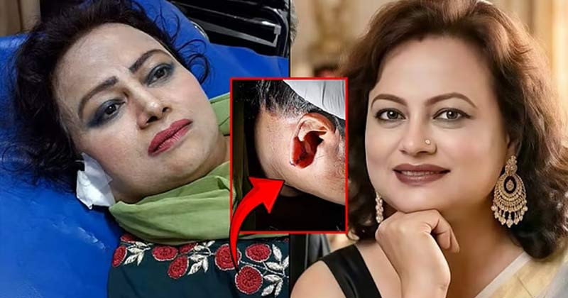 ছিনতাইকারীর হামলায় আহত অভিনেত্রী রঞ্জিতা কনা
